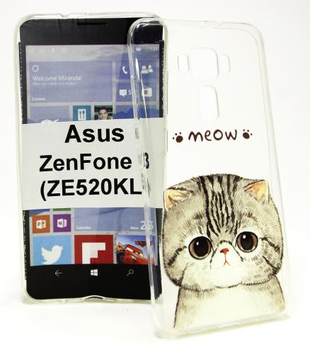 TPU Designcover Asus ZenFone 3 (ZE520KL)