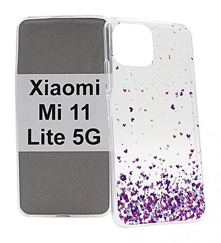 TPU Designcover Xiaomi Mi 11 Lite / Mi 11 Lite 5G