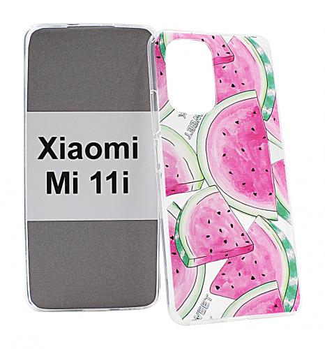 TPU Designcover Xiaomi Mi 11i