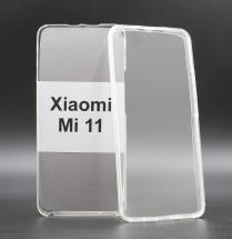 Front & Back Cover Xiaomi Mi 11