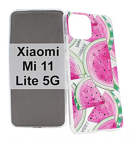 TPU Designcover Xiaomi Mi 11 Lite / Mi 11 Lite 5G