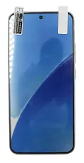 Sk&aelig;rmbeskyttelse Xiaomi 15