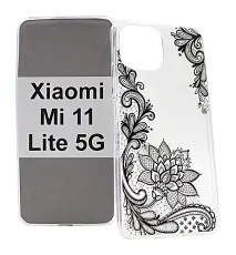 TPU Designcover Xiaomi Mi 11 Lite / Mi 11 Lite 5G